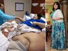 ht_Mayra_Rosales_before_after_ll_131202_4x3_384.jpg